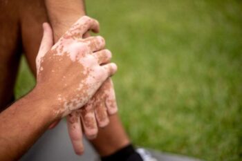 perché compaiono macchie bianche sulla pelle